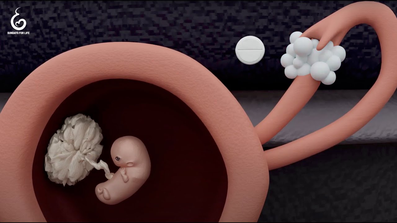 Video: Wie funktioniert die Abtreibungspille?